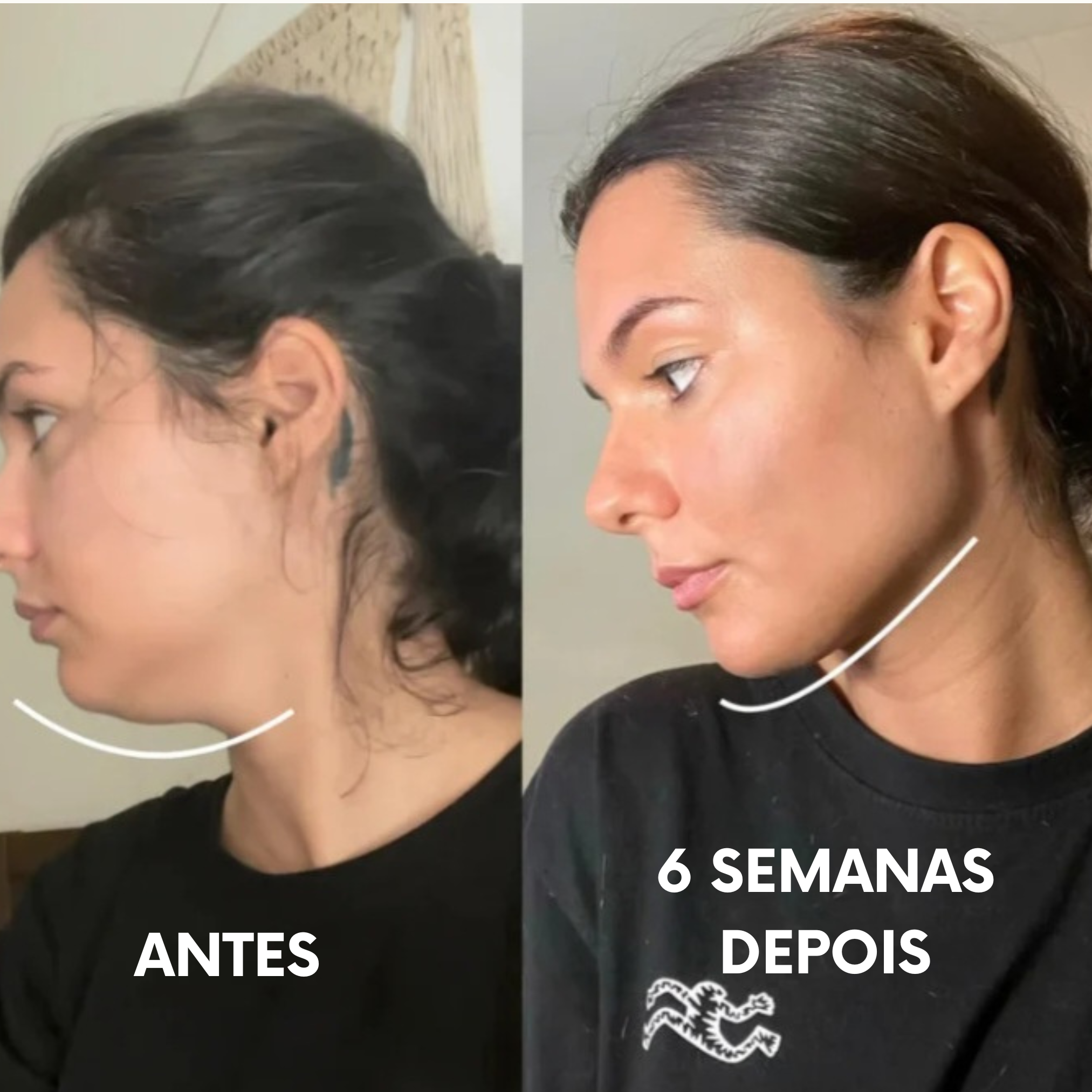 Escova de Drenagem Linfática